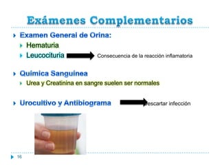 Exámenes Complementarios16Examen General de Orina:Hematuria LeucocituriaConsecuencia de la reacción inflamatoriaQuímica SanguíneaUrea y Creatinina en sangre suelen ser normalesUrocultivo y Antibiograma                Descartar infección