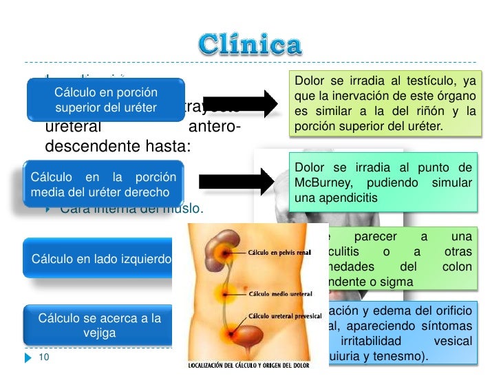 Colico Renal - (2017-01-17) COLICO RENAL (PPT) : El cólico renal está