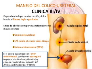 MANEJO DEL COLICO URETERAL
CLINICA III/IV
Si el cálculo está ubicado en unión
ureterovesical, puede sufrir estranguria
(urgencia miccional con polaquiuria y
esfuerzo miccional) por irritación del
detrusor, estimulada por el cálculo
Dependiendo lugar de obstrucción, dolor
irradia al flanco, ingle y genitales
Sitios de obstrucción: partes anatómicamente
mas estrechas:
Unión pieloureteral
1/3 medio al cruzar vasos iliacos
Unión ureterovesical (60%)
 