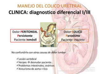 MANEJO DEL COLICO URETERAL
CLINICA: diagnostico diferencial I/III
Dolor COLICO
Paroxismo
Paciente Inquieto
Dolor PERITONEAL
Persistente
Paciente Inmóvil
No confundirlo con otras causas de dolor lumbar:
Lesión vertebral
Herpes  desnudar paciente..
Problemas intestinales, ováricos
Aneurisma de aorta-> Eco
 