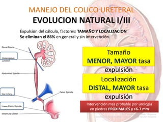 MANEJO DEL COLICO URETERAL
EVOLUCION NATURAL I/III
Tamaño
MENOR, MAYOR tasa
expulsión
Intervención mas probable por urología
en piedras PROXIMALES y >6-7 mm
Localización
DISTAL, MAYOR tasa
expulsión
Expulsion del cálculo, factores: TAMAÑO Y LOCALIZACION
Se eliminan el 86% en general y sin intervención.
 