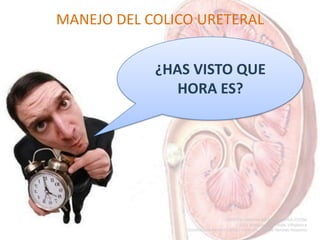 MANEJO DEL COLICO URETERAL
¿HAS VISTO QUE
HORA ES?
 