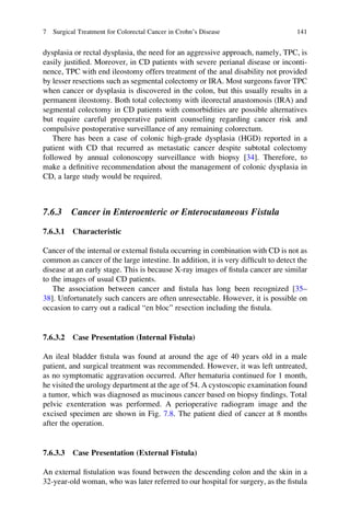 dysplasia or rectal dysplasia, the need for an aggressive approach, namely, TPC, is
easily justiﬁed. Moreover, in CD patients with severe perianal disease or inconti-
nence, TPC with end ileostomy offers treatment of the anal disability not provided
by lesser resections such as segmental colectomy or IRA. Most surgeons favor TPC
when cancer or dysplasia is discovered in the colon, but this usually results in a
permanent ileostomy. Both total colectomy with ileorectal anastomosis (IRA) and
segmental colectomy in CD patients with comorbidities are possible alternatives
but require careful preoperative patient counseling regarding cancer risk and
compulsive postoperative surveillance of any remaining colorectum.
There has been a case of colonic high-grade dysplasia (HGD) reported in a
patient with CD that recurred as metastatic cancer despite subtotal colectomy
followed by annual colonoscopy surveillance with biopsy [34]. Therefore, to
make a deﬁnitive recommendation about the management of colonic dysplasia in
CD, a large study would be required.
7.6.3 Cancer in Enteroenteric or Enterocutaneous Fistula
7.6.3.1 Characteristic
Cancer of the internal or external ﬁstula occurring in combination with CD is not as
common as cancer of the large intestine. In addition, it is very difﬁcult to detect the
disease at an early stage. This is because X-ray images of ﬁstula cancer are similar
to the images of usual CD patients.
The association between cancer and ﬁstula has long been recognized [35–
38]. Unfortunately such cancers are often unresectable. However, it is possible on
occasion to carry out a radical “en bloc” resection including the ﬁstula.
7.6.3.2 Case Presentation (Internal Fistula)
An ileal bladder ﬁstula was found at around the age of 40 years old in a male
patient, and surgical treatment was recommended. However, it was left untreated,
as no symptomatic aggravation occurred. After hematuria continued for 1 month,
he visited the urology department at the age of 54. A cystoscopic examination found
a tumor, which was diagnosed as mucinous cancer based on biopsy ﬁndings. Total
pelvic exenteration was performed. A perioperative radiogram image and the
excised specimen are shown in Fig. 7.8. The patient died of cancer at 8 months
after the operation.
7.6.3.3 Case Presentation (External Fistula)
An external ﬁstulation was found between the descending colon and the skin in a
32-year-old woman, who was later referred to our hospital for surgery, as the ﬁstula
7 Surgical Treatment for Colorectal Cancer in Crohn’s Disease 141
 