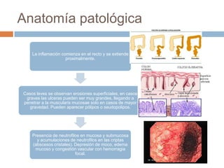 Anatomía patológica

    La inflamación comienza en el recto y se extiende
                     proximalmente.




Casos leves se observan erosiones superficiales, en casos
 graves las ulceras pueden ser muy grandes, llegando a
penetrar a la muscularis mucosae solo en casos de mayor
  gravedad. Pueden aparecer pólipos o seudopolipos.




    Presencia de neutrofilos en mucosa y submucosa
      y acumulaciones de neutrofilos en las criptas
    (abscesos cristales). Depresión de moco, edema
     mucoso y congestión vascular con hemorragia
                          focal.
 
