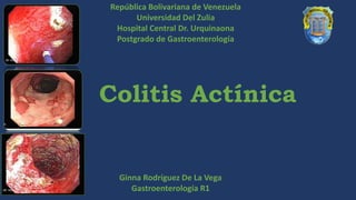 Colitis Actínica
Ginna Rodríguez De La Vega
Gastroenterología R1
República Bolivariana de Venezuela
Universidad Del Zulia
Hospital Central Dr. Urquinaona
Postgrado de Gastroenterología
 