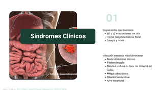 Síndromes Clínicos
01
En pacientes con disentería:
10 y 12 evacuaciones por día
Heces con poca material fecal
Sangre y moco
Infección intestinal más fulminante
Dolor abdominal intenso
Fiebre elevada
Diarrea profusa es rara, se observa en
niños
Mega colon tóxico
Dilatación intestinal
Aire intramural
Longo, D., & Fauci, A. S. (2013). Harrison’s Gastroenterology and Hepatology (2a ed.). McGraw-Hill Medical.
 