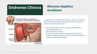 Absceso hepático
Amebiano
La mayoría de los pacientes padece fiebre y dolor en el cuadrante
abdominal superior derecho, que puede ser sordo o pleurítico e
incluso se irradia hacia el hombro
Se acompaña sobre un punto sensible sobre el hígado y
derrame pleural derecho
33% padece diarrea activa
Ancianos de áreas endémicas probabilidad de sufrir una
evolución subaguda, duración de seis meses acompañada de
adelgazamiento y hepatomegalia
Síndromes Clínicos
Longo, D., & Fauci, A. S. (2013). Harrison’s Gastroenterology and Hepatology (2a ed.). McGraw-Hill Medical.
 