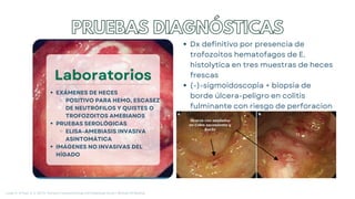 Laboratorios
EXÁMENES DE HECES
POSITIVO PARA HEMO, ESCASEZ
DE NEUTRÓFILOS Y QUISTES O
TROFOZOITOS AMEBIANOS
PRUEBAS SEROLÓGICAS
ELISA-AMEBIASIS INVASIVA
ASINTOMÁTICA
IMÁGENES NO INVASIVAS DEL
HÍGADO
PRUEBAS DIAGNÓSTICAS
Dx definitivo por presencia de
trofozoitos hematofagos de E.
histolytica en tres muestras de heces
frescas
(-)-sigmoidoscopia + biopsia de
borde úlcera-peligro en colitis
fulminante con riesgo de perforacion
Longo, D., & Fauci, A. S. (2013). Harrison’s Gastroenterology and Hepatology (2a ed.). McGraw-Hill Medical.
 