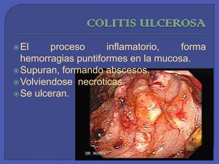 COLITIS ULCEROSAEl proceso inflamatorio, forma hemorragias puntiformes en la mucosa.Supuran, formando abscesos.Volviendosenecroticas.Se ulceran.  