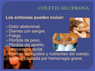 COLITIS ULCEROSALos síntomas pueden incluir:Dolor abdominal. Diarrea con sangre. Fatiga. Pérdida de peso. Pérdida del apetito. Hemorragia rectal. Pérdida de líquidos y nutrientes del cuerpo. Anemia causada por hemorragia grave. 