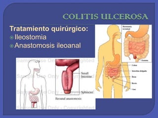 COLITIS ULCEROSATratamiento quirúrgico: IleostomiaAnastomosis ileoanal