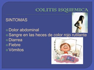 COLITIS ISQUEMICA SINTOMASDolor abdominal Sangre en las heces de color rojo rutilante Diarrea Fiebre Vómitos 