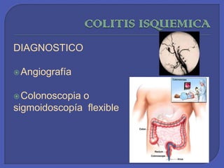 COLITIS ISQUEMICA DIAGNOSTICO Angiografía Colonoscopia o sigmoidoscopía  flexible 