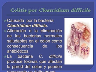 Colitis por ClostridiumdifficileCausada  por la bacteria Clostridiumdifficile.Alteración o la eliminación de las bacterias normales saludables en el colon como consecuencia de los antibióticos. La bacteria C. difficileproduce toxinas que afectan la pared del colon y pueden provocarle un daño grave.