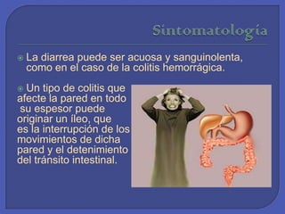 SintomatologíaLa diarrea puede ser acuosa y sanguinolenta, como en el caso de la colitis hemorrágica. Un tipo de colitis que afecte la pared en todo su espesor puede originar un íleo, que es la interrupción de los movimientos de dicha pared y el detenimiento del tránsito intestinal. 