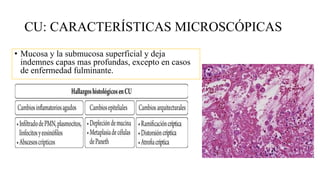 CU: CARACTERÍSTICAS MICROSCÓPICAS
• Mucosa y la submucosa superficial y deja
indemnes capas mas profundas, excepto en casos
de enfermedad fulminante.
 