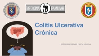 R2 FRANCISCO JAVIER ESPITIA ROMERO
Colitis Ulcerativa
Crónica
 