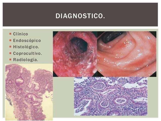 Colitis ulcerosa partnersuche