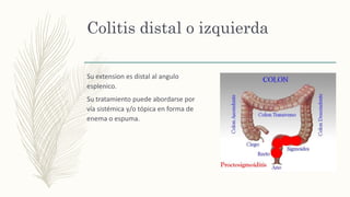 Colitis distal o izquierda
Su extension es distal al angulo
esplenico.
Su tratamiento puede abordarse por
vía sistémica y/o tópica en forma de
enema o espuma.
 
