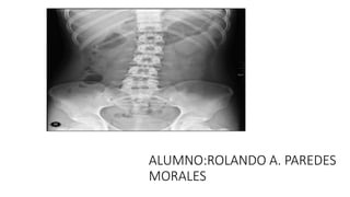 ALUMNO:ROLANDO A. PAREDES
MORALES
 