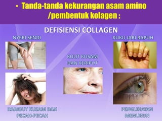 • Tanda-tanda kekurangan asam amino
         /pembentuk kolagen :
       DEFISIENSI COLLAGEN
 