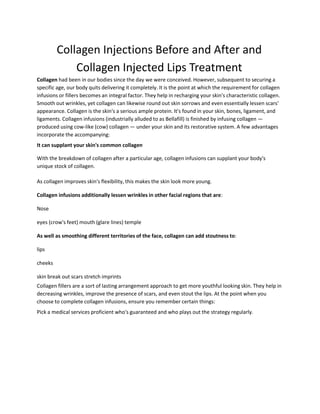 Collagen Injections Before and After and
Collagen Injected Lips Treatment
Collagen had been in our bodies since the day we were conceived. However, subsequent to securing a
specific age, our body quits delivering it completely. It is the point at which the requirement for collagen
infusions or fillers becomes an integral factor. They help in recharging your skin's characteristic collagen.
Smooth out wrinkles, yet collagen can likewise round out skin sorrows and even essentially lessen scars'
appearance. Collagen is the skin's a serious ample protein. It's found in your skin, bones, ligament, and
ligaments. Collagen infusions (industrially alluded to as Bellafill) is finished by infusing collagen —
produced using cow-like (cow) collagen — under your skin and its restorative system. A few advantages
incorporate the accompanying:
It can supplant your skin's common collagen
With the breakdown of collagen after a particular age, collagen infusions can supplant your body's
unique stock of collagen.
As collagen improves skin's flexibility, this makes the skin look more young.
Collagen infusions additionally lessen wrinkles in other facial regions that are:
Nose
eyes (crow's feet) mouth (glare lines) temple
As well as smoothing different territories of the face, collagen can add stoutness to:
lips
cheeks
skin break out scars stretch imprints
Collagen fillers are a sort of lasting arrangement approach to get more youthful looking skin. They help in
decreasing wrinkles, improve the presence of scars, and even stout the lips. At the point when you
choose to complete collagen infusions, ensure you remember certain things:
Pick a medical services proficient who's guaranteed and who plays out the strategy regularly.
 
