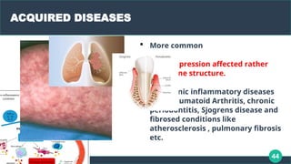 44
ACQUIRED DISEASES
 More common
 Gene expression affected rather
than gene structure.
 Eg Chronic inflammatory diseases
like Rheumatoid Arthritis, chronic
periodontitis, Sjogrens disease and
fibrosed conditions like
atherosclerosis , pulmonary fibrosis
etc.
 