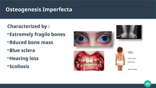 45
Osteogenesis Imperfecta
Characterized by :

Extremely fragile bones

Rduced bone mass

Blue sclera

Hearing loss

Scoliosis
 