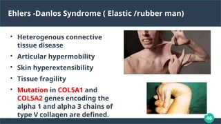 46
Ehlers -Danlos Syndrome ( Elastic /rubber man)

Heterogenous connective
tissue disease

Articular hypermobility

Skin hyperextensibility

Tissue fragility

Mutation in COL5A1 and
COL5A2 genes encoding the
alpha 1 and alpha 3 chains of
type V collagen are defined.
 