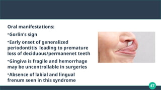 47
Oral manifestations:

Gorlin’s sign

Early onset of generalized
periodontitis leading to premature
loss of deciduous/permanenet teeth

Gingiva is fragile and hemorrhage
may be uncontrollable in surgeries

Absence of labial and lingual
frenum seen in this syndrome
 