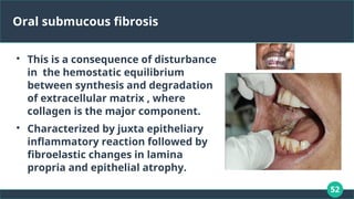 52
Oral submucous fibrosis

This is a consequence of disturbance
in the hemostatic equilibrium
between synthesis and degradation
of extracellular matrix , where
collagen is the major component.

Characterized by juxta epitheliary
inflammatory reaction followed by
fibroelastic changes in lamina
propria and epithelial atrophy.
 