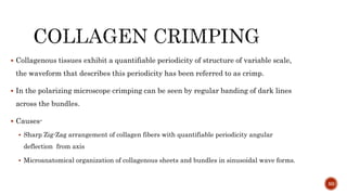  Collagenous tissues exhibit a quantifiable periodicity of structure of variable scale,
the waveform that describes this periodicity has been referred to as crimp.
 In the polarizing microscope crimping can be seen by regular banding of dark lines
across the bundles.
 Causes-
 Sharp Zig-Zag arrangement of collagen fibers with quantifiable periodicity angular
deflection from axis
 Microanatomical organization of collagenous sheets and bundles in sinusoidal wave forms.
50
 