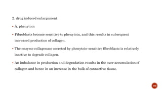 2. drug induced enlargement
 A. phenytoin
 Fibroblasts become sensitive to phenytoin, and this results in subsequent
increased production of collagen.
 The enzyme collagenase secreted by phenytoin-sensitive fibroblasts is relatively
inactive to degrade collagen.
 An imbalance in production and degradation results in the over accumulation of
collagen and hence in an increase in the bulk of connective tissue.
89
 