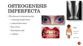  The disease is characterized by-
 extremely fragile bones
 reduced bone mass
 blue sclera,
 hearing loss and
 scoli...