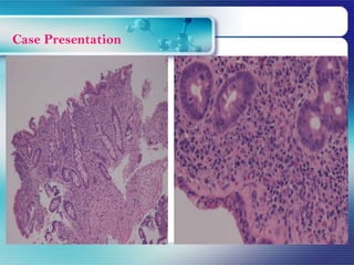 Case Presentation
 