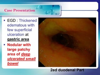  EGD : Thickened
edematous with
few superficial
ulceration at
gastric area
 Nodular with
large patchy
area of deep
ulcerated small
bowel
Case Presentation
2ed duodenal Part
 