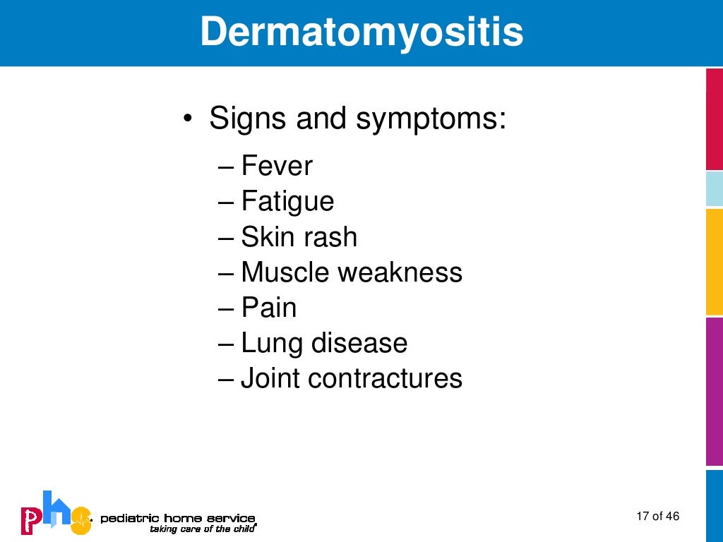Collagen Vascular Disease in Children