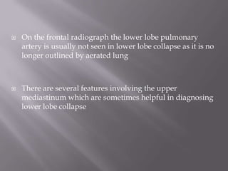  On the frontal radiograph the lower lobe pulmonary
artery is usually not seen in lower lobe collapse as it is no
longer outlined by aerated lung
 There are several features involving the upper
mediastinum which are sometimes helpful in diagnosing
lower lobe collapse
 