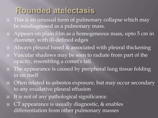  This is an unusual form of pulmonary collapse which may
be misdiagnosed as a pulmonary mass.
 Appears on plain film as a homogeneous mass, upto 5 cm in
diameter, with ill-defined edges
 Always pleural based & associated with pleural thickening
 Vascular shadows may be seen to radiate from part of the
opacity, resembling a comet's tail.
 The appearance is caused by peripheral lung tissue folding
in on itself
 Often related to asbestos exposure, but may occur secondary
to any exudative pleural effusion
 It is not of any pathological significance.
 CT appearance is usually diagnostic, & enables
differentiation from other pulmonary masses
 