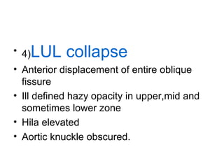 LUL collapse

• 4)

• Anterior displacement of entire oblique
fissure
• Ill defined hazy opacity in upper,mid and
sometimes lower zone
• Hila elevated
• Aortic knuckle obscured.

 