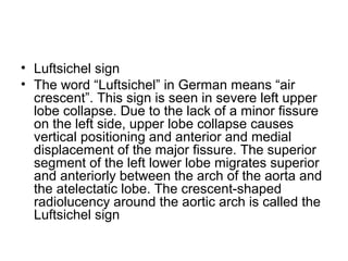 • Luftsichel sign
• The word “Luftsichel” in German means “air
crescent”. This sign is seen in severe left upper
lobe collapse. Due to the lack of a minor fissure
on the left side, upper lobe collapse causes
vertical positioning and anterior and medial
displacement of the major fissure. The superior
segment of the left lower lobe migrates superior
and anteriorly between the arch of the aorta and
the atelectatic lobe. The crescent-shaped
radiolucency around the aortic arch is called the
Luftsichel sign

 