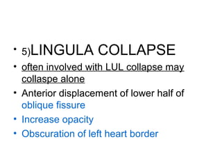 • 5)LINGULA COLLAPSE
• often involved with LUL collapse may
collaspe alone
• Anterior displacement of lower half of
oblique fissure
• Increase opacity
• Obscuration of left heart border

 