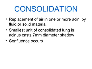 CONSOLIDATION
• Replacement of air in one or more acini by
fluid or solid material
• Smallest unit of consolidated lung is
acinus casts 7mm diameter shadow
• Confluence occurs

 