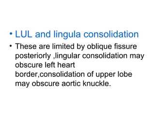 • LUL and lingula consolidation
• These are limited by oblique fissure
posteriorly ,lingular consolidation may
obscure left heart
border,consolidation of upper lobe
may obscure aortic knuckle.

 