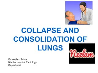 COLLAPSE AND
CONSOLIDATION OF
LUNGS
Dr Neelam Ashar
Nishtar hospital Radiology
Department

 
