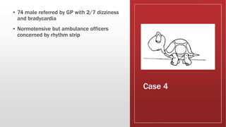 Case 4
▪ 74 male referred by GP with 2/7 dizziness
and bradycardia
▪ Normotensive but ambulance officers
concerned by rhythm strip
 