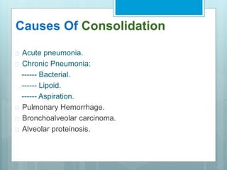 Causes Of Consolidation 
 Acute pneumonia. 
 Chronic Pneumonia: 
------ Bacterial. 
------ Lipoid. 
------ Aspiration. 
 Pulmonary Hemorrhage. 
 Bronchoalveolar carcinoma. 
 Alveolar proteinosis. 
 