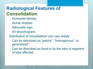Radiological Features of 
Consolidation 
 Increased density. 
 Acinar shadow. 
 Silhouette sign. 
 Air bronchogram. 
Distribution of consolidation can vary widely. 
 Can be described as “patchy”, “homogenous”, or 
generalized”. 
 Can be described as focal or by the lobe or segment 
of lobe affected. 
 