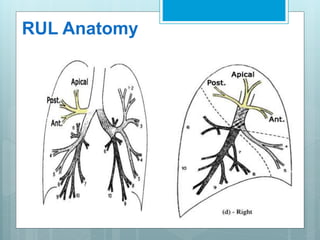 RUL Anatomy 
 
