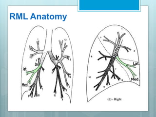RML Anatomy 
 